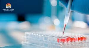 titer test for dogs